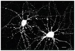 CaMKII, Mouse, Clone: 22B1, Abnova 100&mu;g; Unlabeled:Antibodies, Monoclonal