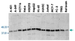 MAPK14, Mouse, Clone: 9F12, Abnova 100&mu;g; Unlabeled:Anticuerpos