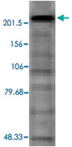 Cacna1d, Mouse, Clone: S48A-9, Abnova 100 &mu;g | Buy Online | Abnova | Fisher Scientific