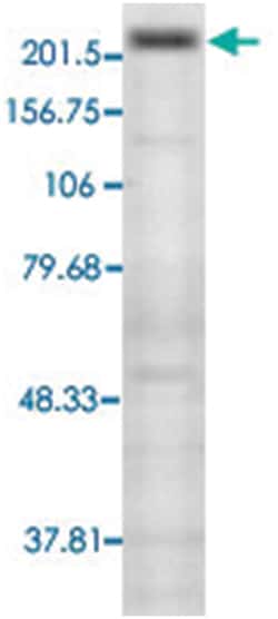 Trpm7, Mouse, Clone: S74-25, Abnova 100&mu;g; Unlabeled:Antibodies, Monoclonal
