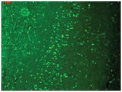 Trpm7, Mouse, Clone: S74-25, Abnova 100&mu;g; Unlabeled:Antibodies, Monoclonal