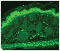 Trpv3, Mouse, Clone: S15-4, Abnova 100&mu;g; Unlabeled:Antibodies, Monoclonal