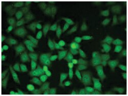 Glo1, Rat, Clone: 6F10, Abnova 100 &mu;g | Buy Online | Abnova | Fisher Scientific