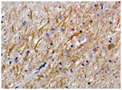 CSPG4, Mouse, Clone: LHM 2, Abnova 100&mu;g; Unlabeled:Antibodies, Monoclonal