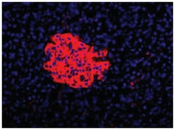 Endocrine cell marker, Mouse, Clone: HIC1-7H10, Abnova 100 &mu;L | Buy Online | Abnova Corporation | Fisher Scientific