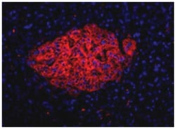 Endocrine cell marker, Mouse, Clone: HIC0-4F9, Abnova 100 &mu;L | Buy Online | Abnova | Fisher Scientific