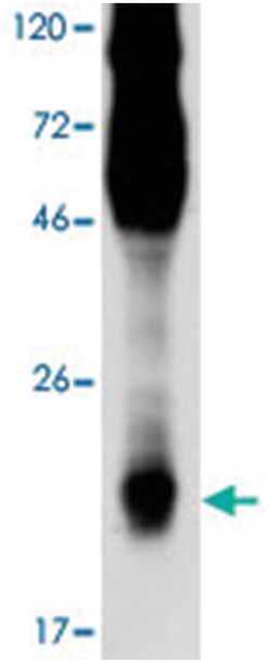 THY1, Mouse, Clone: aTHy-1A1, Abnova 100 &mu;g | Buy Online | Abnova Corporation | Fisher Scientific