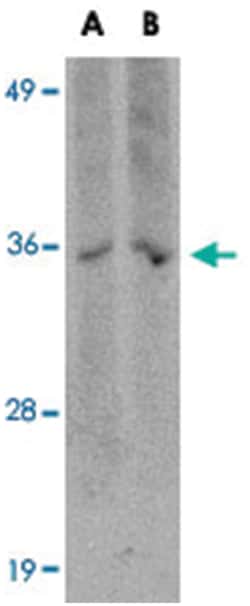 HAX1, Mouse, Clone: 9G3D11, Abnova 100&mu;g; Unlabeled:Antibodies, Monoclonal