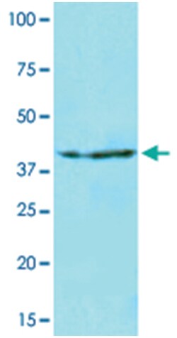 NAT6, Mouse, Clone: AT2F4, Abnova 100&mu;L; Unlabeled:Antibodies, Monoclonal
