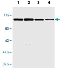 APAF1, Mouse, Clone: 22D7, Abnova 100 &mu;L | Buy Online | Abnova Corporation | Fisher Scientific