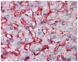 SLC2A2, Mouse, Clone: 5D1, Abnova 50&mu;g; Unlabeled:Antibodies, Monoclonal