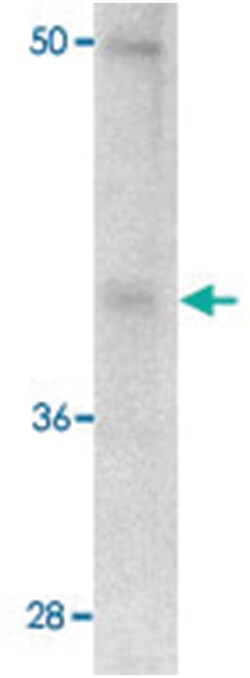 Pdcd1, Mouse, Clone: 12A7D7, Abnova 100&mu;g; Unlabeled:Antibodies, Monoclonal