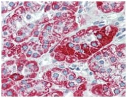 TRPC6, Mouse, Clone: 3F2.H10.F2, Abnova 100&mu;g; Unlabeled:Antibodies,