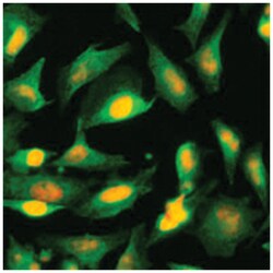 AGXT, Mouse, Clone: AT2T4, Abnova 100&mu;L; Unlabeled:Antibodies, Monoclonal