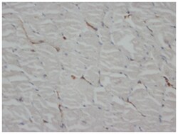 ACTB, Mouse, Clone: AC-15, Abnova 100&mu;g; Unlabeled:Antibodies, Monoclonal