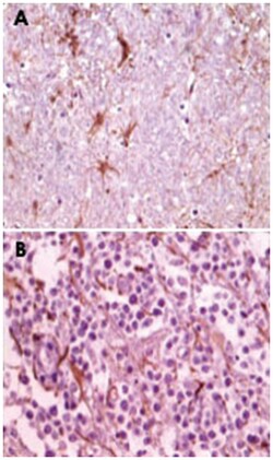 CIB1, Mouse, Clone: 5A1F5E12, 5A1H7E12, Abnova 100&mu;g; Unlabeled:Antibodies,