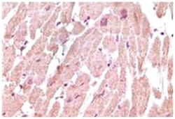 TNNI3, Mouse, Clone: 3A10A12, 5C3A7, Abnova 100&mu;L; Unlabeled:Antibodies,