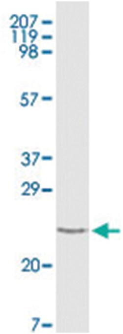 TNNI3, Mouse, Clone: 3A10A12, 5C3A7, Abnova 100&mu;L; Unlabeled:Antibodies,