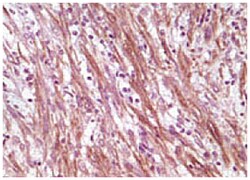 DES, Mouse, Clone: 10H7D2, Abnova 100&mu;g; Unlabeled:Antibodies, Monoclonal