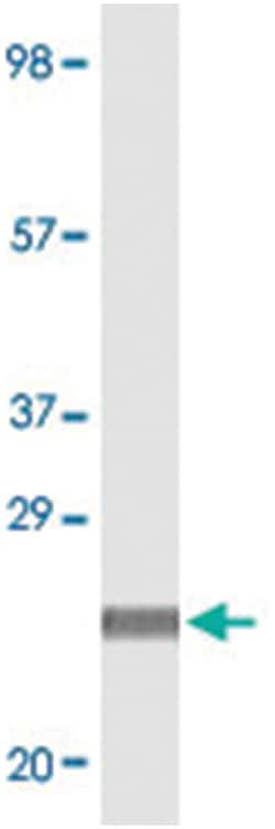 DES, Mouse, Clone: 10H7D2, Abnova 100&mu;g; Unlabeled:Antibodies, Monoclonal