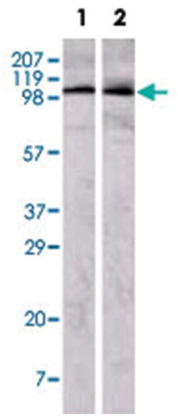 EPHA1, Mouse, Clone: 5D2D1, Abnova 100 &mu;g | Buy Online | Abnova | Fisher Scientific