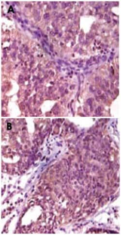EPHA1, Mouse, Clone: 5D2D1, Abnova 100 &mu;g | Buy Online | Abnova | Fisher Scientific