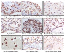 CDKN2A, Mouse, Clone: 5A8A4, 3G8D12, Abnova 100&mu;L; Unlabeled:Antibodies,