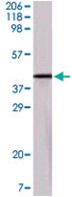 OVA, Mouse, Clone: 3G2E1D9, Abnova 100 &mu;g | Buy Online | Abnova Corporation | Fisher Scientific