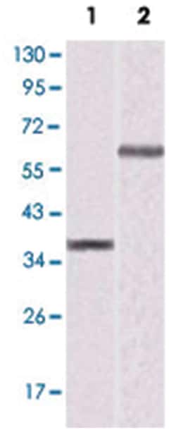 PPARG, Mouse, Clone: 5D2, Abnova 100&mu;L; Unlabeled:Antibodies, Monoclonal