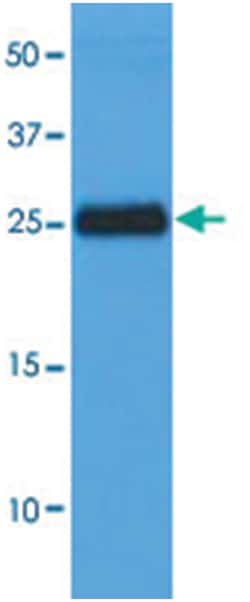 CLEC4E, Mouse, Clone: AT16E3, Abnova 100&mu;L; Unlabeled:Antibodies, Monoclonal