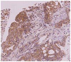 CLEC4E, Mouse, Clone: AT16E3, Abnova 100&mu;L; Unlabeled:Antibodies, Monoclonal
