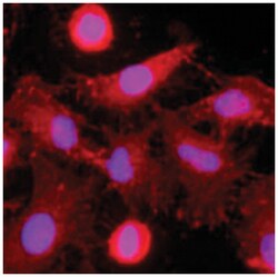 CLEC4E, Mouse, Clone: AT16E3, Abnova 100&mu;L; Unlabeled:Antibodies, Monoclonal