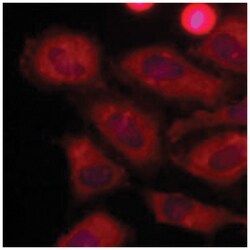 LDHA, Mouse, Clone: AT1A4, Abnova 100&mu;L; Unlabeled:Antibodies, Monoclonal