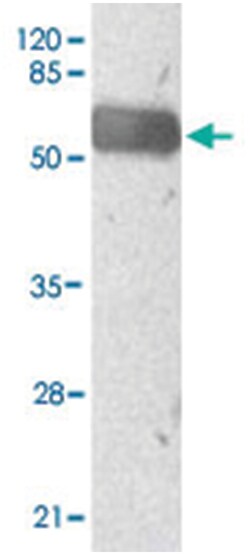 MYST4, Mouse, Monoclonal Antibody, Abnova 100&mu;g; Unlabeled:Antibodies,