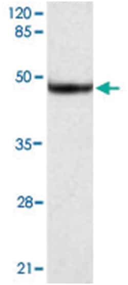 HSPA5, Mouse, Monoclonal Antibody, Abnova 100 &mu;g | Buy Online | Abnova | Fisher Scientific