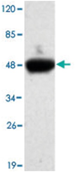CDH5, Mouse, Monoclonal Antibody, Abnova 100&mu;g; Unlabeled:Antibodies,