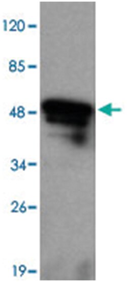 MAP2 Mouse anti-Human, Monoclonal Antibody, Abnova 100&mu;g; Unlabeled:Antibodies,