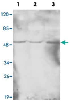 HAT1, Mouse, Monoclonal Antibody, Abnova 100 &mu;g | Buy Online | Abnova Corporation | Fisher Scientific