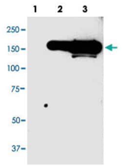 CFP, Mouse, Clone: 98s55, Abnova 100&mu;g; Unlabeled:Antibodies, Monoclonal
