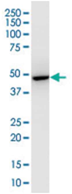 FAH, Mouse, Clone: 665a3, Abnova 100&mu;L; Unlabeled:Antibodies, Monoclonal