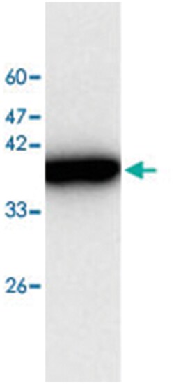 FAH, Mouse, Clone: 665a3, Abnova 100&mu;L; Unlabeled:Antibodies, Monoclonal