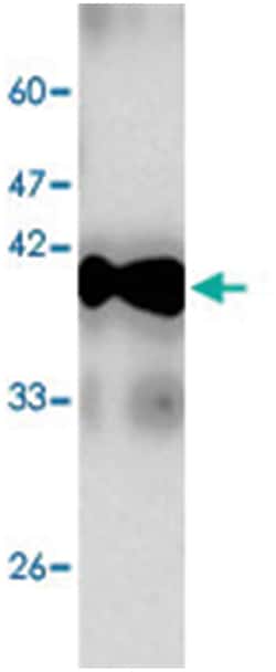 NUPR1, Mouse, Clone: 60a6, Abnova 100&mu;L; Unlabeled:Antibodies, Monoclonal