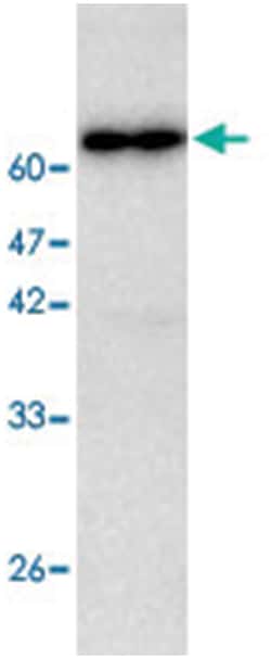 CTSC, Mouse, Clone: 97a6, Abnova 100&mu;L; Unlabeled:Antibodies, Monoclonal