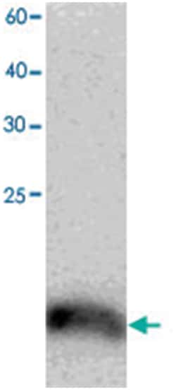 TCEB2, Mouse, Clone: 9y74, Abnova 100&mu;L; Unlabeled:Antibodies, Monoclonal