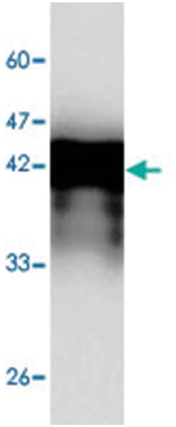 CCND1, Mouse, Clone: 0c65, Abnova 100&mu;L; Unlabeled:Antibodies, Monoclonal