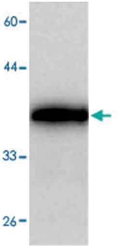 MATR3, Mouse, Clone: 3665a, Abnova 100 &mu;L | Buy Online | Abnova | Fisher Scientific