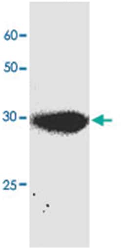 RFP tag, Mouse, Clone: 9x95, Abnova 100 &mu;L | Buy Online | Abnova Corporation | Fisher Scientific