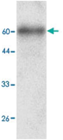 ICAM1, Mouse, Clone: 5f87, Abnova 100 &mu;L | Buy Online | Abnova Corporation | Fisher Scientific