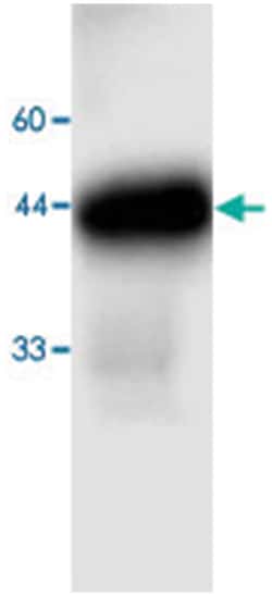 PRDX5, Mouse, Clone: 9g056, Abnova 100&mu;L; Unlabeled:Anticuerpos
