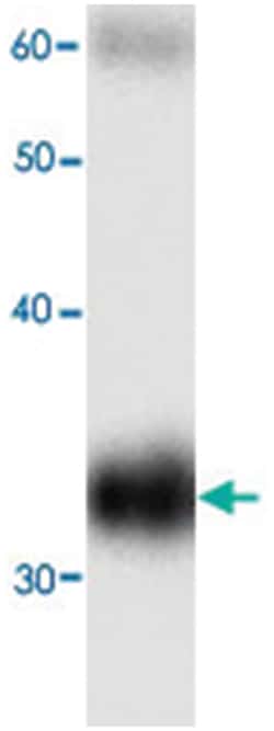 HBB, Mouse, Clone: 99g8, Abnova 100&mu;L; Unlabeled:Antibodies, Monoclonal